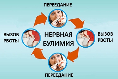Лечение булимии в Тетюшах
